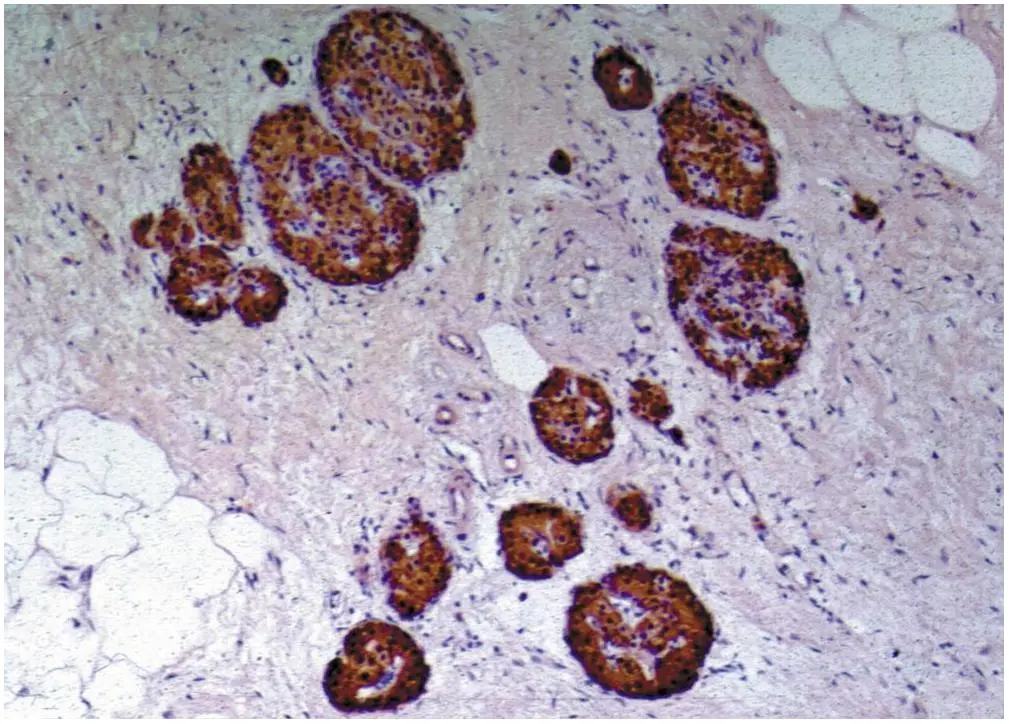 Immunohistochemistry staining of human pancreas (paraffin-embedded sections) with anti-human to C-peptide of Proinsulin (C-PEP-01) (GTX27761).