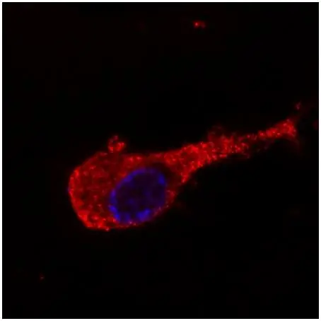 ICC/IF analysis of Neuro2a cells using GTX27794 NF-M antibody [NF-09].<br>Red : Primary antibody<br>Blue : DAPI