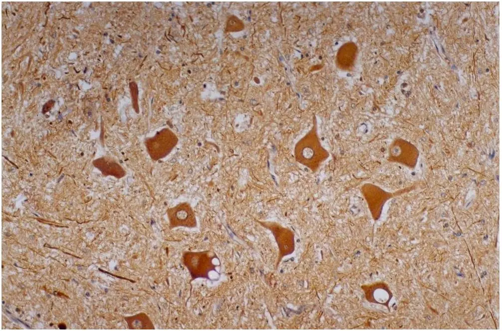 Immunohistochemistry staining of human cerebellum (paraffin-embedded sections) with anti-Neurofilament heavy protein (NF-01) (GTX27795).