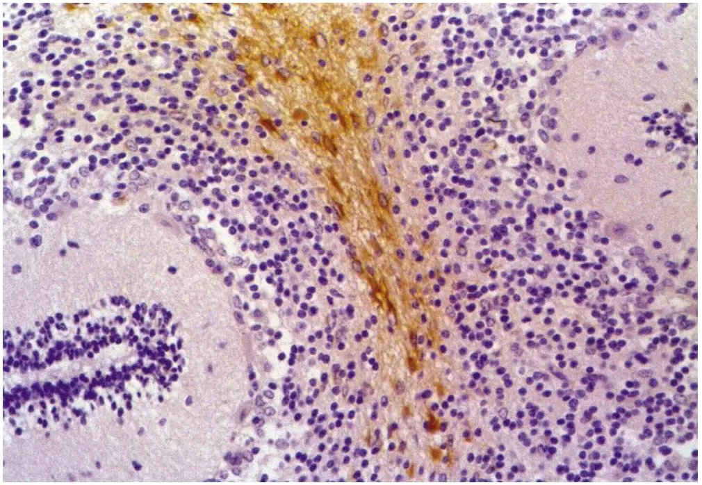 Immunohistochemistry staining of human cerebellum (paraffin-embedded sections) with anti-GFAP (clone GF-01) (GTX27806).