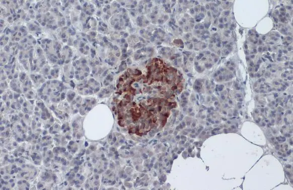 Insulin antibody detects Insulin protein at cytoplasm by immunohistochemical analysis.</br>Sample: Paraffin-embedded human pancreas.</br>Insulin stained by Insulin antibody (GTX27842) diluted at 1:50.</br>Antigen Retrieval: Citrate buffer, pH 6.0, 15 min