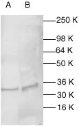 WB analysis of HeLa (A) and MCF-7 (B) whole cell lysates using GTX27978 Caspase 1 antibody. Dilution : 1:200 WB analysis of HeLa (A) and MCF-7 (B) whole cell lysates using GTX27978 Caspase 1 antibody. Dilution : 1:200