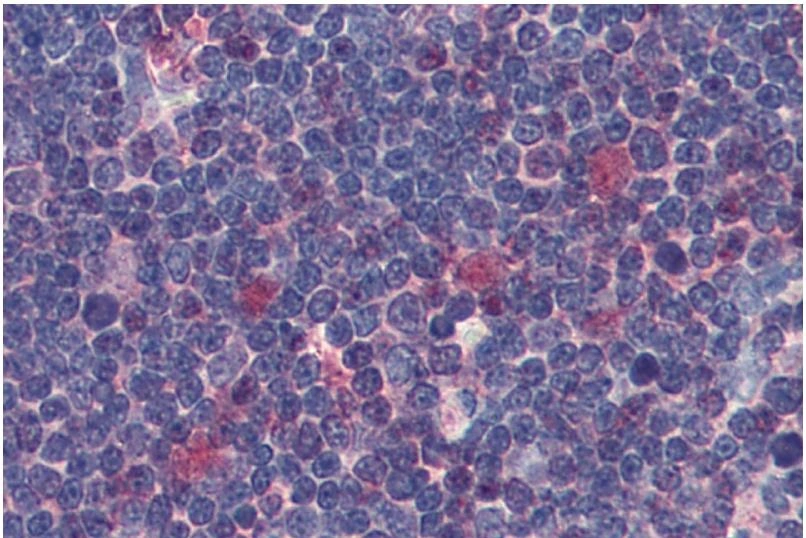Immunohistochemistry staining of human thymus (paraffin sections) using anti-Cdk1 (clone POH-1) (GTX28040).