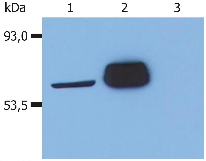 WB analysis of various samples using GTX28075 Lck antibody [LCK-01]. Lane 1 : J. CaM-1.6 (a mutant derivate of the JURKAT cell line) transfected with Lck Lane 2 : HEK-293T transfected with Lck Lane 3 : HEK-293T (non-transfected)