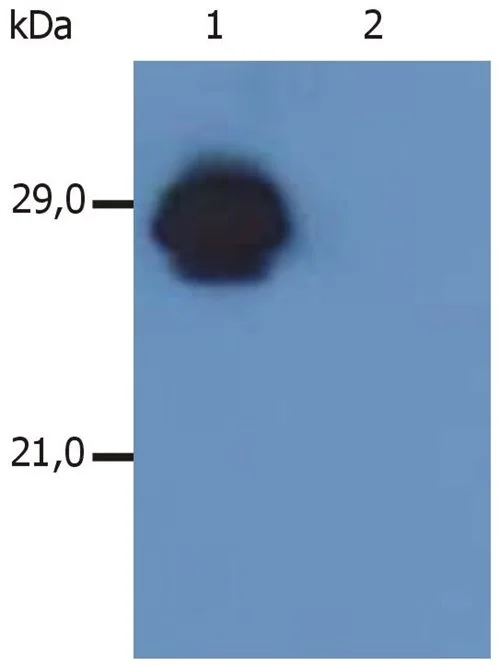 WB analysis of Raji cell lysate using GTX28094 HLA-DR + HLA-DP antibody [MEM-136]. Lane 1 : GTX28094 Lane 2 : mouse IgG1 isotype control