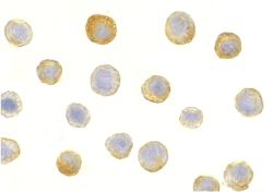 ICC/IF analysis of HeLa cells using GTX28109 IL1RAP antibody. Dilution : 5microg/ml ICC/IF analysis of HeLa cells using GTX28109 IL1RAP antibody. Dilution : 5microg/ml
