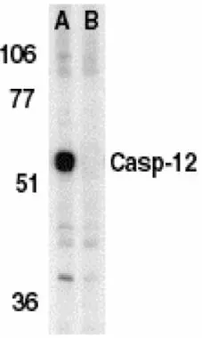 Western blot analysis of Caspase-12 in mouse brain tissue lysate in the absence (A) or presence (B) of blocking peptide with Caspase-12 antibody (GTX28117)at 1microg/ml.
