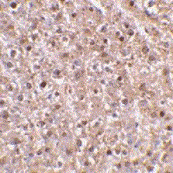Staining of formailin fixed paraffin processed mouse liver with anti-Caspase 12 at 2ug/ml (GTX28117) Staining of formailin fixed paraffin processed mouse liver with anti-Caspase 12 at 2ug/ml (GTX28117)