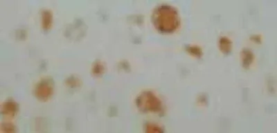 IHC-P analysis of maturing and the hypertrophic cartilage tissue using GTX28132 Neurofibromin antibody.