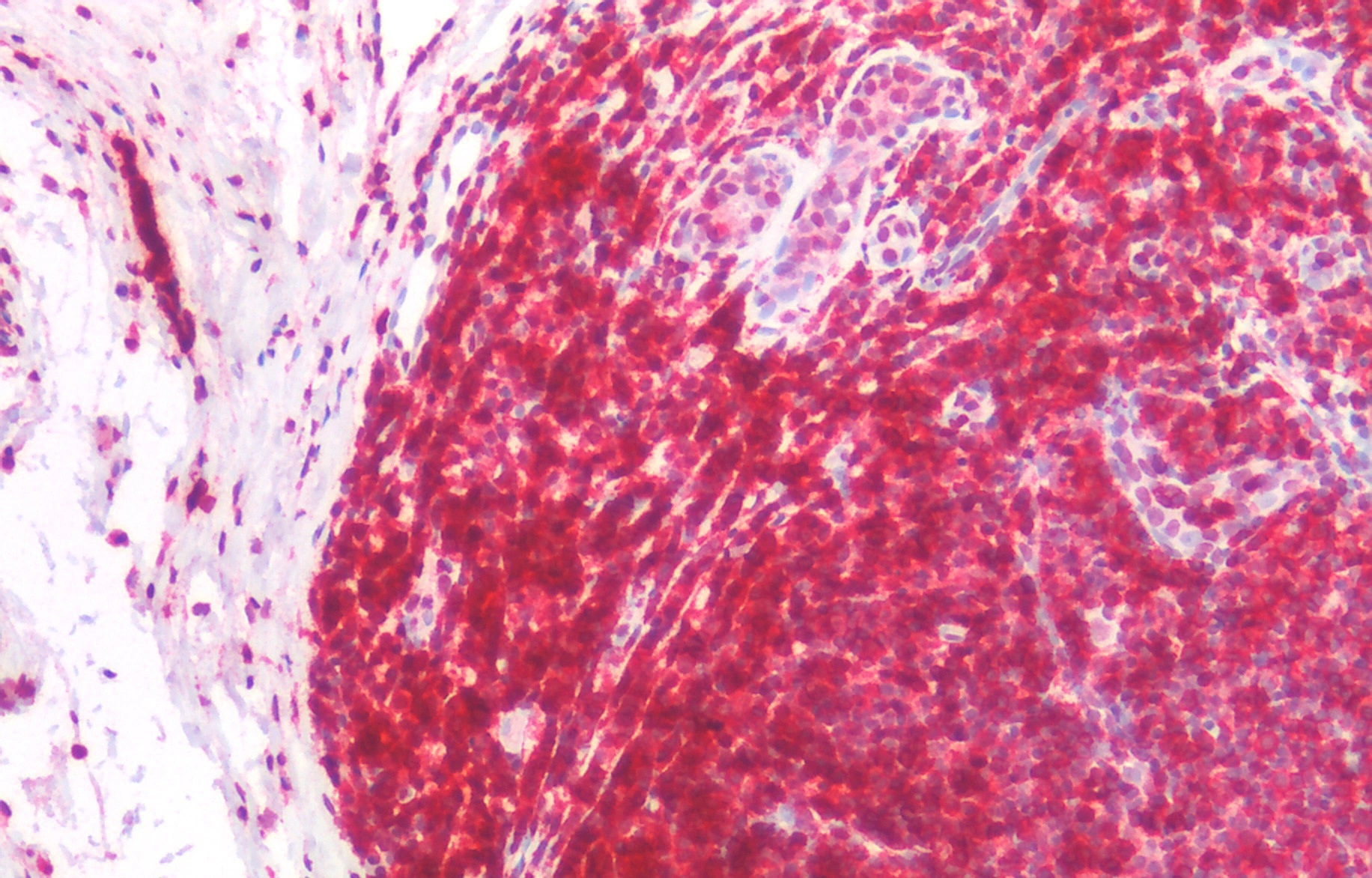 IHC-P analysis of human tonsil tissue using GTX28217 CD45RA antibody [MEM-56]. Diultion : 5microg/ml