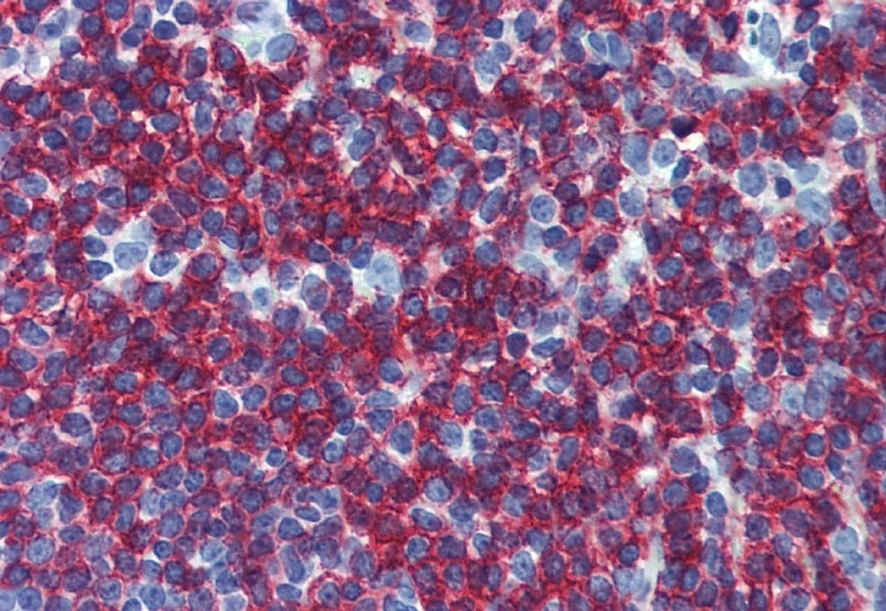 Immunohistochemistry staining of tonsil (paraffin-embedded sections) with anti-CD45RB (MEM-55) (GTX28218).
