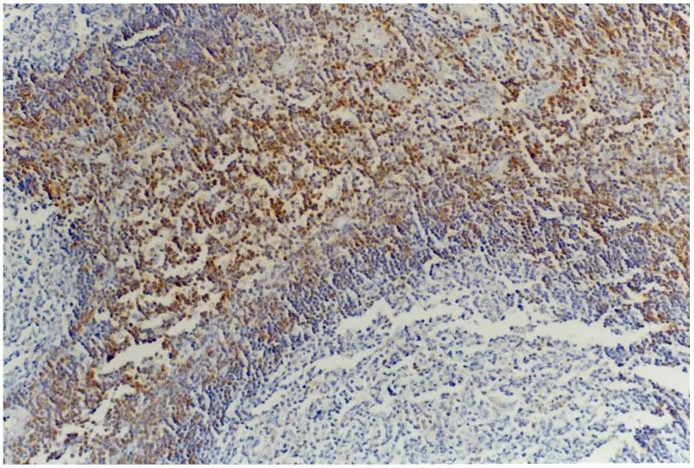 CD45RB antibody [MEM-55]