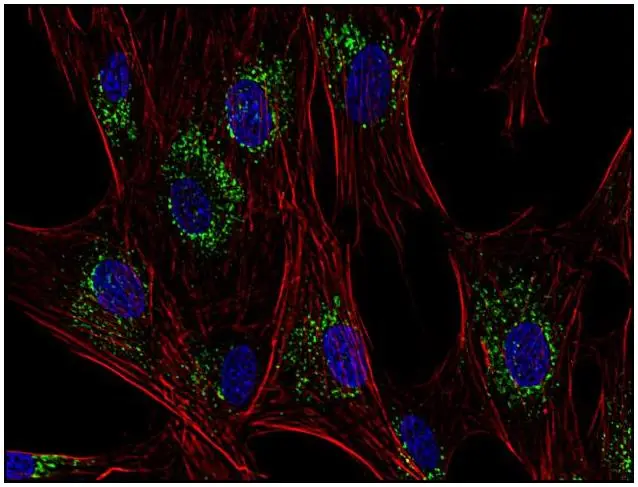 ICC/IF analysis of human primary fibroblasts using GTX28219 CD63 antibody [MEM-259]. Green : Primary antibody Red : Actin Blue : DAPI