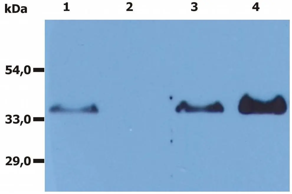 IP analysis of Raji cell lysate using GTX28237 CD20 antibody [MEM-97]. The signal was detected by another Rabbit polyclonal anti-CD20 antibody in WB assay. Lane 1 : Raji cell lysate Lane 2 : Immunoprecipitate by mouse IgG1 isotype control Lane 3 : Raji cell lysate Lane 4 : Immunoprecipitate by GTX28237