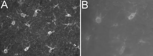GTX28330 at a dilution of 1/1000, staining S100 (Alexa 488 secondary at 1/2000) on rat brain tissue (30m thick coronal sections) in free floating IHC (see protocol link for detailed description). Images showing neuron body and processes: [A] 20x objective