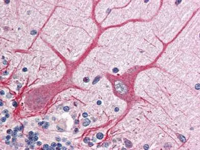IHC-P analysis of human brain cerebellum tissue using Notch 1 antibody at a dilution of 1:500. The image shows the localization of antibody as the precipitated red signal, with a hematoxylin purple nuclear counter stain. IHC-P analysis of human brain cerebellum tissue using Notch 1 antibody at a dilution of 1:500. The image shows the localization of antibody as the precipitated red signal, with a hematoxylin purple nuclear counter stain.