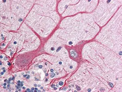 IHC-P analysis of human cerebellum tissue using GTX28387 NOTCH1 antibody. Dilution : 1:500