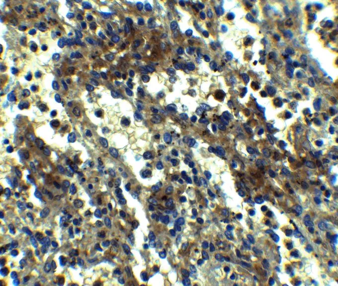 IHC-P analysis of formaldehyde fixed Human Spleen Tissue using GTX28394 TMS1 antibody. Antigen retreival : Heat mediation with a citrate buffer (pH6) Dilution : 2.5microg/mL