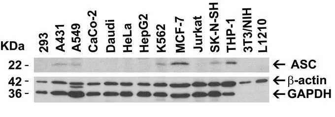 WB analysis of various samples using GTX28394 TMS1 antibody. Dilution : 2microg/mL Loading : 15microg of lysates per lane