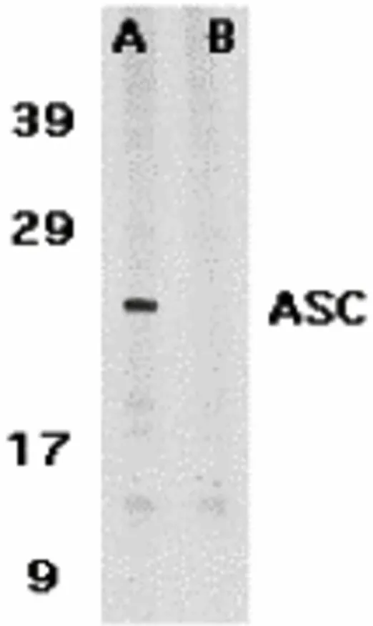 WB analysis of HL-60 cell lysate using GTX28394 TMS1 antibody in the absence (A) or presence (B) of blocking peptide. Dilution : 1microg/mL Loading : 15microg of lysates per lane