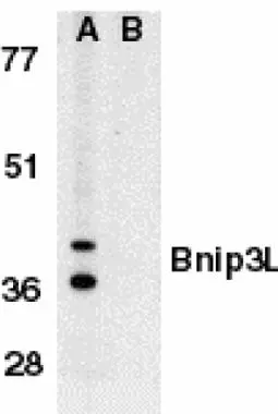 Western blot analysis of Bnip3L in K562 whole cell lysate in the absence (A), or presence (B) of immunogenic peptide with Bnip3L antibody (GTX28399) at 1microg/ml.