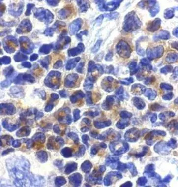 Immunohistochemical staining of DAPK2 in mouse spleen cells with DAPK2 antibody (GTX28404) at 2microg/ml. Immunohistochemical staining of DAPK2 in mouse spleen cells with DAPK2 antibody (GTX28404) at 2microg/ml.