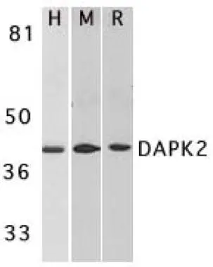 Western blot analysis of DAPK2 in A431 (H), mouse spleen (M), and rat kidney (R) lysates with DAPK2 antibody (GTX28404) at 1microg/ml.