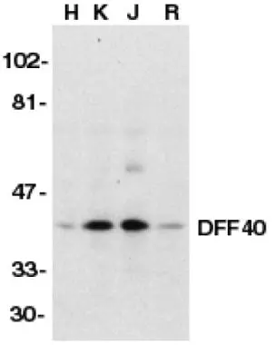 Western blot analysis of DFF40/CAD in HeLa (H), K562 (K), Jurkat (J), and Raji (R) whole cell lysate with DFF40/CAD antibody (GTX28406) at 1microg/ml.