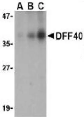 Immunocytochemical staining of DFF40 in K562 cells with CAD antibody (GTX28407) at 10ug/ml.
