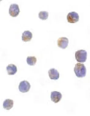 Immunocytochemical staining of DRAK2 in Jurkat cells with DRAK2 antibody (GTX28419) at 10microg/ml. Immunocytochemical staining of DRAK2 in Jurkat cells with DRAK2 antibody (GTX28419) at 10microg/ml.
