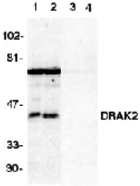 Western blot analysis of DRAK2 in Jurkat (1,3) and Raji (2,4) cell lysate in the absence (1,2) or presence (3,4) of blocking peptide with DRAK2 antibody (GTX28419) at 1 g/ml.