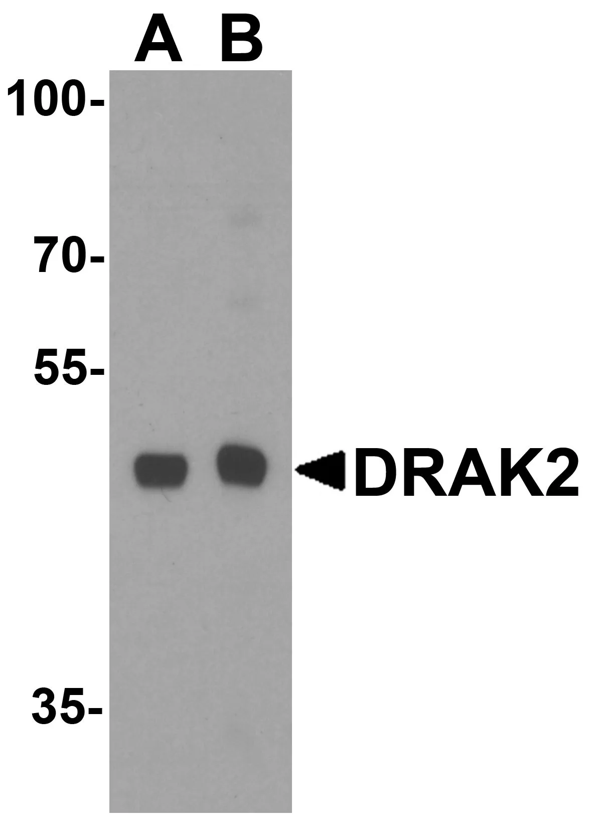 WB analysis of Raji cell lysate using GTX28419 DRAK2 antibody. Dilution : 1microg/ml (Lane A) and 2 microg/ml (Lane B)