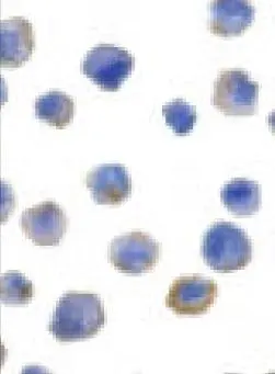 Immunocytochemical staining of FLIP in HeLa cells with FLIP antibody (GTX28421) at 5microg/ml. Immunocytochemical staining of FLIP in HeLa cells with FLIP antibody (GTX28421) at 5microg/ml.