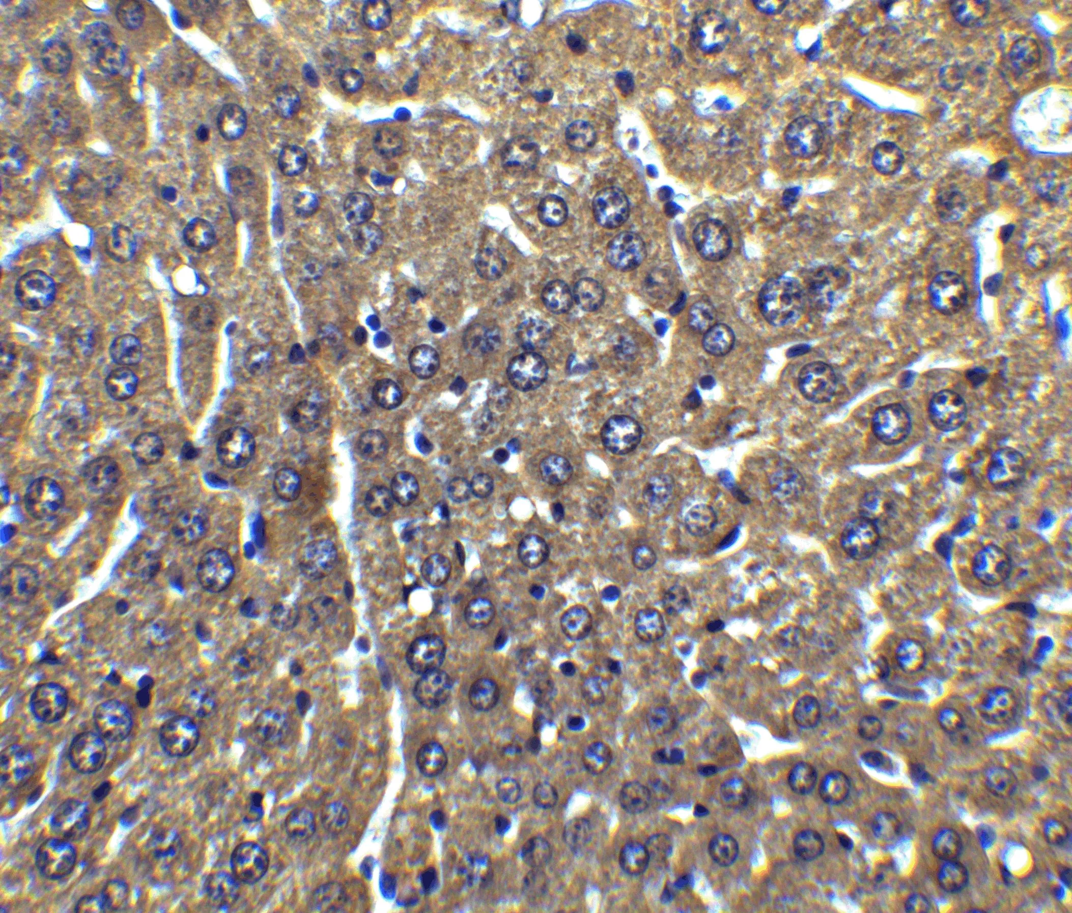 IHC-P analysis of mouse liver tissue using GTX28421 FLIP antibody. Dilution : 5 microg/ml