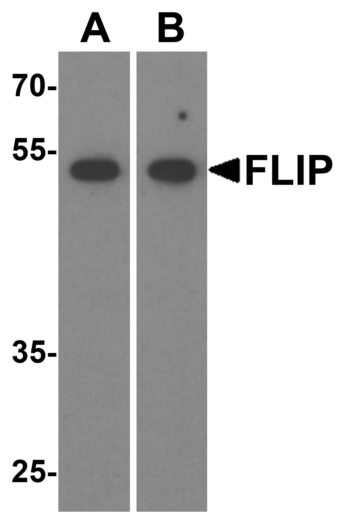 WB analysis of (A) HeLa cell and (B) mouse liver tissue lysate using GTX28421 FLIP antibody. Dilution : 1 microg/ml