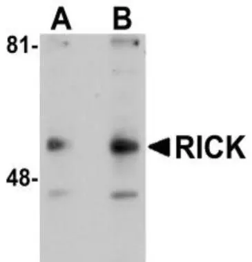 Western blot analysis of RIP2 in A431 cell lysate with RIP2 antibody (GTX28427) at (A) 1 and (B) 2microg/ml.