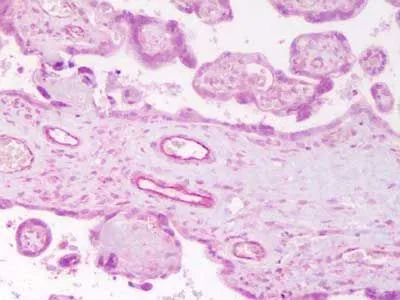 IHC-P of anti-ANG2 Antibody (GTX28452) in human placenta tissue. Antigen Retrieval: Heat, Citrate pH 6.2. Pressure Cooker Primary antibody: 2ug/ml for 1.5 hour RT. IHC-P of anti-ANG2 Antibody (GTX28452) in human placenta tissue. Antigen Retrieval: Heat, Citrate pH 6.2. Pressure Cooker Primary antibody: 2ug/ml for 1.5 hour RT.