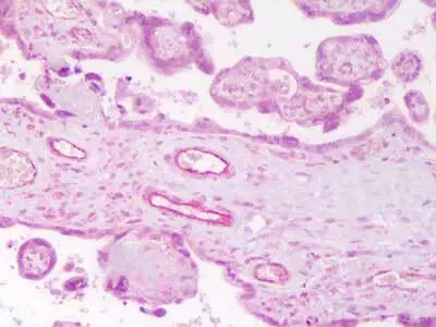 IHC-P analysis of human placenta tissue using GTX28452 Angiopoietin 2 antibody. Antigen retrieval : Head mediated citrate buffer (pH 6.2) Dilution : 2 microg/mL