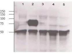 WB analysis of mouse-angiopoietin-expressing endothelial whole cell lysate using GTX28452 Angiopoietin 2 antibody. Lane 1 : Mock Lane 2 : Mouse Arg2 expressing whole cell lysate Lane 3 : Mouse Arg1 (clone 1-15) expressing whole cell lysate Lane 4 : Mouse Arg1 (clone 1-8) expression whole cell lysate Lane 5 : Wild type Loading : 20 microg Dilution : 1:500