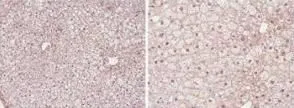 Immunohistochemistry showing GeneTexs PPAR alpha antibody staining of PPAR alpha protein in mouse liver tissue section (Formalin/PFA-fixed paraffin-embedded sections). Tissue underwent formaldehyde fixation before enzymatic antigen retrieval with 0.05% protease in PBS for 5 minutes. Sample was then blocked with 5% serum for 20 minutes at 20oC. The primary antibody was diluted 1:50 and incubated with sample in Tris plus 5% normal goat serum for 1 hour at 20oC. A biotinylated goat polyclonal to rabbit IgG was used at dilution at 1:500 as secondary antibody. Images show nuclear staining in hepatocytes (perfusion-fixed mouse, 10 and 40x microscope magnification).