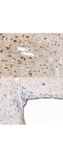 Immunohistochemistry using GeneTexs anti-PPAR antibody, showing staining of PPAR alpha in rat brain sections, highlighting cytoplasmic staining in ependymal cells and neurons in frontal cortex. Bottom image shows subventricular zone (svz) of lateral ventrical (exit point of progenitor olfactory neurones); top image shows frontal cortex in the same section. Cytoplasmic staining is also observed in the corpus callosum (bottom image) and in dendritic fields of the cortex. Formalin/PFA-fixed paraffin-embedded sections of rat brain tissue were incubated with the primary antibody at 1:200 for 1 hour. Antigen retrieval was performed by heat induction in citrate buffer pH 6.0.