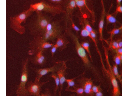 ICC/IF analysis of PFA-fixed HepG2 cells using GTX28934 PPAR alpha antibody. Green : Primary antibody Red : Plasma membrane Blue : DAPI Dilution : 1 microg/mL