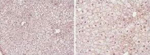 IHC-P analysis of mouse liver tissue using GTX28934 PPAR alpha antibody. Antigen retrieval : 0.05% protease in PBS Dilution : 1:50