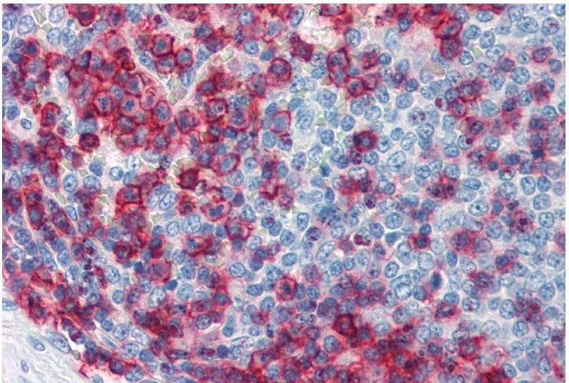 IHC-P analysis of human spleen tissue using GTX29088 CD43 antibody [MEM-59].