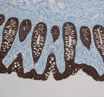 Immunohistochemistry on paraffin section of human colon Immunohistochemistry on paraffin section of human colon