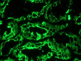 Immunohistochemistry on frozen section of human kidney