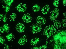 Immunohistochemistry on frozen section of human small intestine