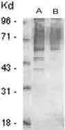 Immunoblotting of fetal mouse brain extract (125 ug - A and 25 ug - B)