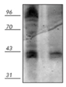 Western blot analysis of mouse spleen extract probed with GTX29337. Left Lane: Vanadium treated Right lane: Untreated Western blot analysis of mouse spleen extract probed with GTX29337. Left Lane: Vanadium treated Right lane: Untreated