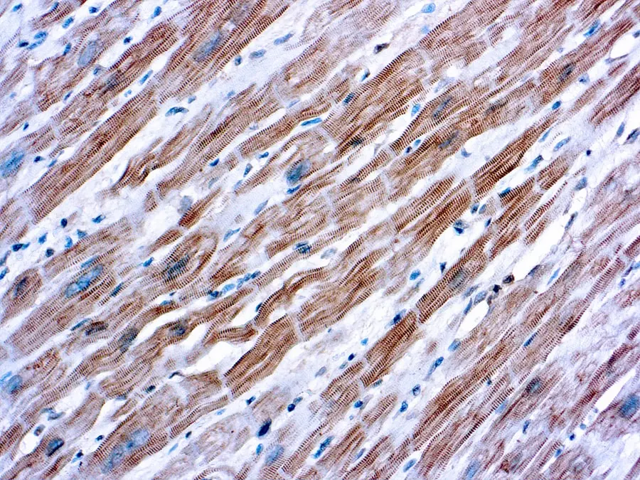 Formalin fixed paraffin embedded human skeletal muscle stained with ?-Actinin (sarcomeric) antibody.